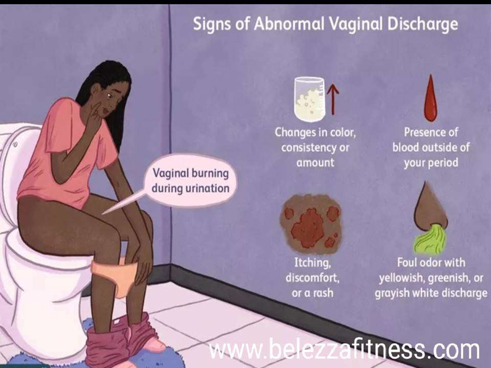 Is my vaginal discharge normal?
